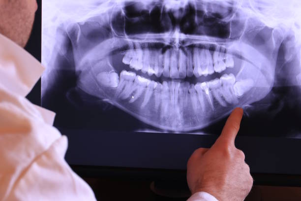 Best Emergency Tooth Extraction in Jamestown, KY