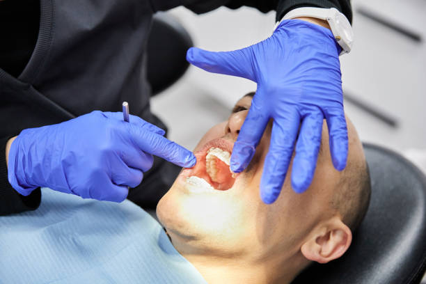 Best Emergency Gum Treatment in Jamestown, KY